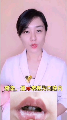 #育儿#如何区分新生儿鹅口疮、马牙、奶块?