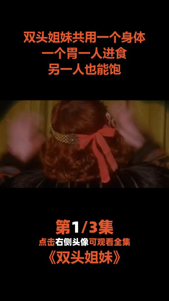 双头姐妹共用一个身体一个胃,一人进食,另一人也能饱1