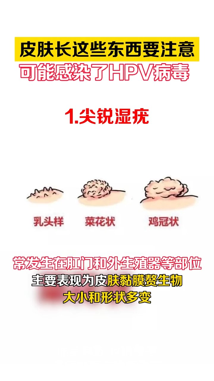 #尖锐湿疣#皮肤上长这些要注意!可能感染HPV病毒了!