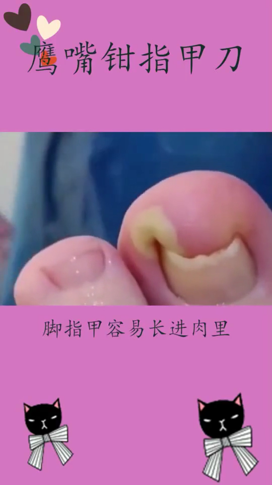 #双11好物推荐#不进修脚店的密