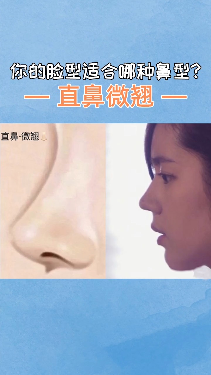 #隆鼻#你的脸型适合哪种鼻型?直鼻微翘