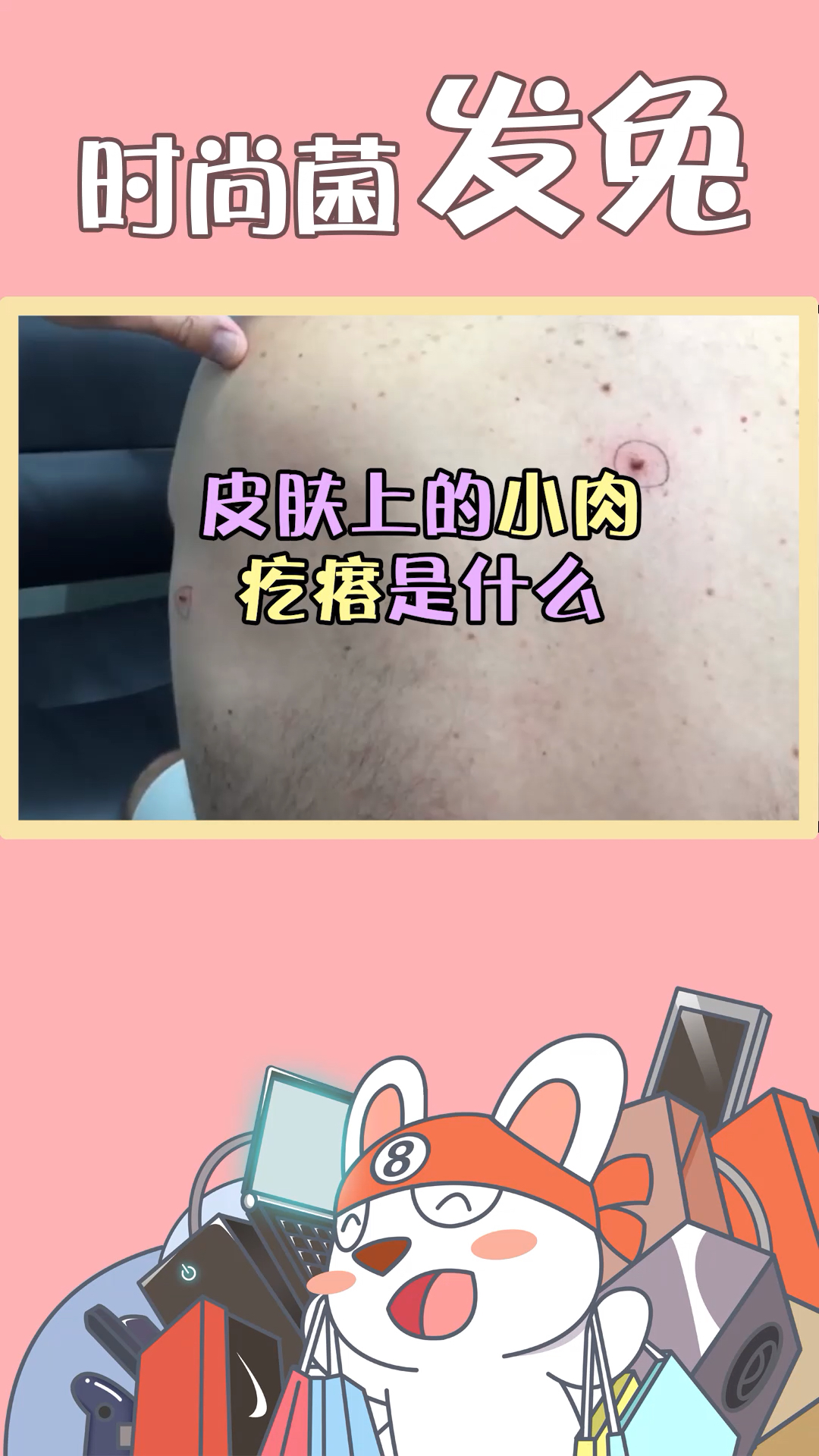 我们皮肤上的小肉疙瘩是什么呢?快看看你的身上有没有!