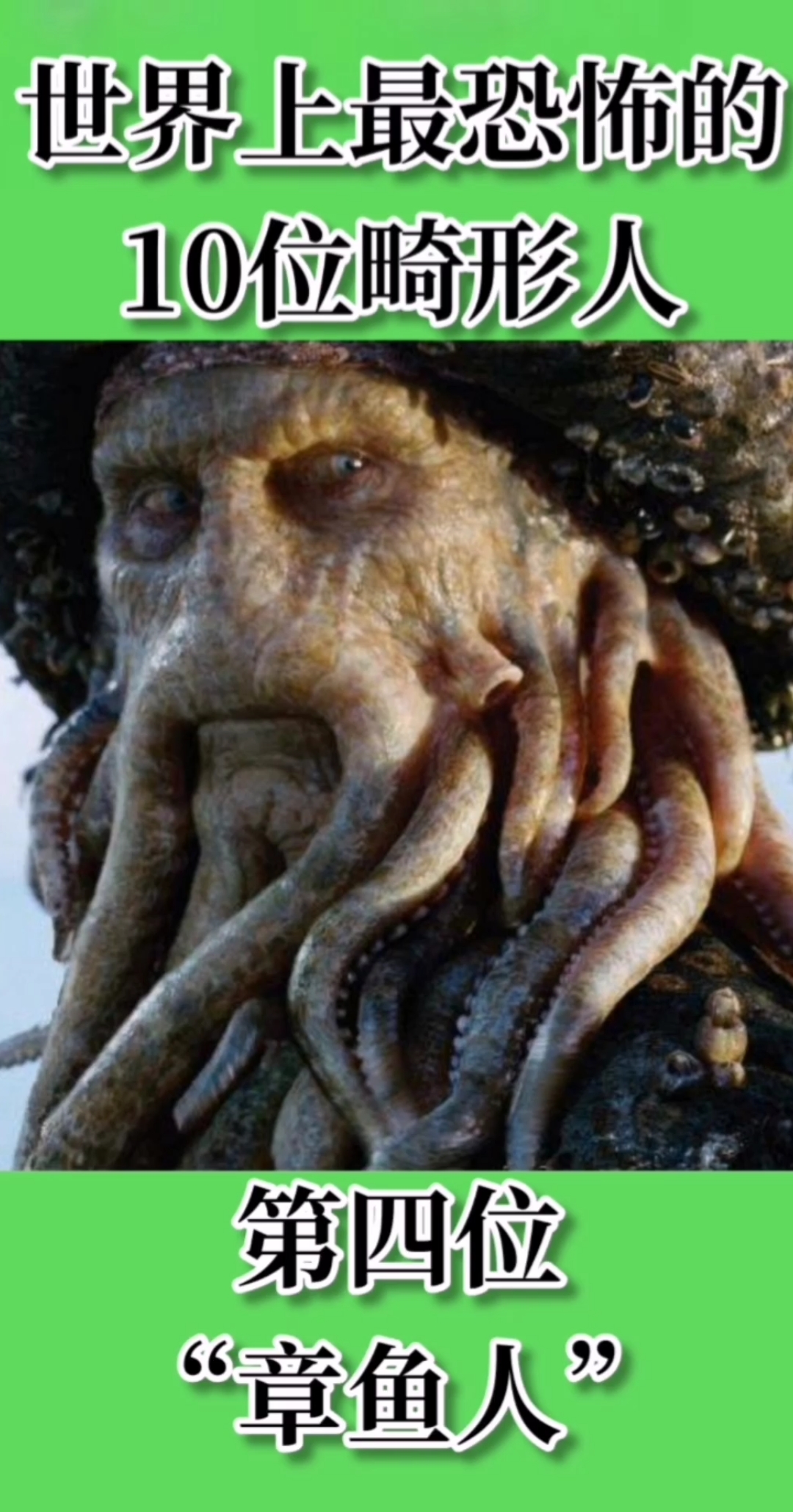 世界上最恐怖的。10位畸形人。第四位。“章鱼人”
