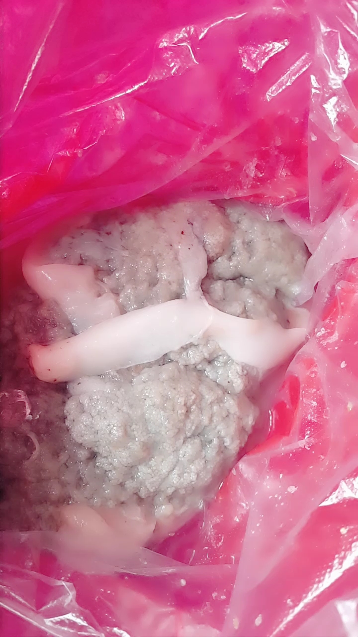 早上买来的鱼籽,放到湖里不知道能不活啊,希望老天让它们变成小鱼,健康成长啊