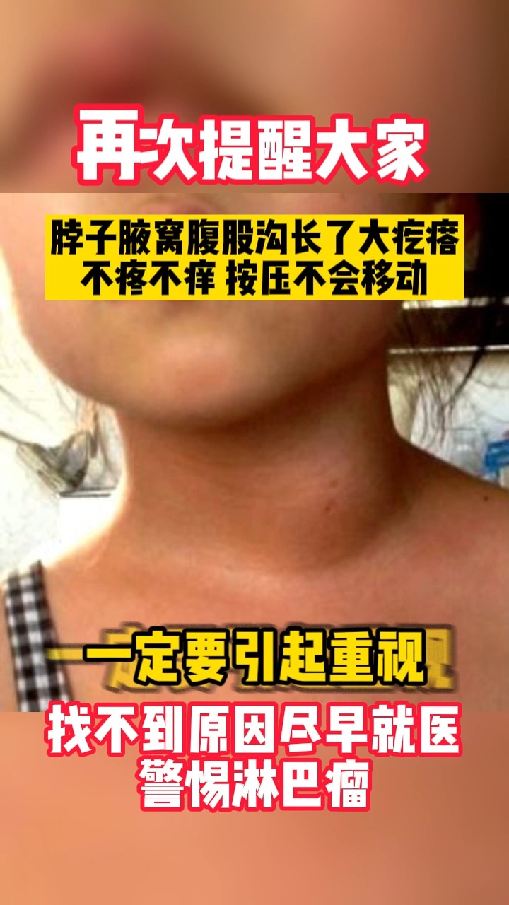 #淋巴结肿大#再次提醒大家,脖子腋窝腹股沟长了大疙瘩,不疼不痒,按压不会移动需要注意!