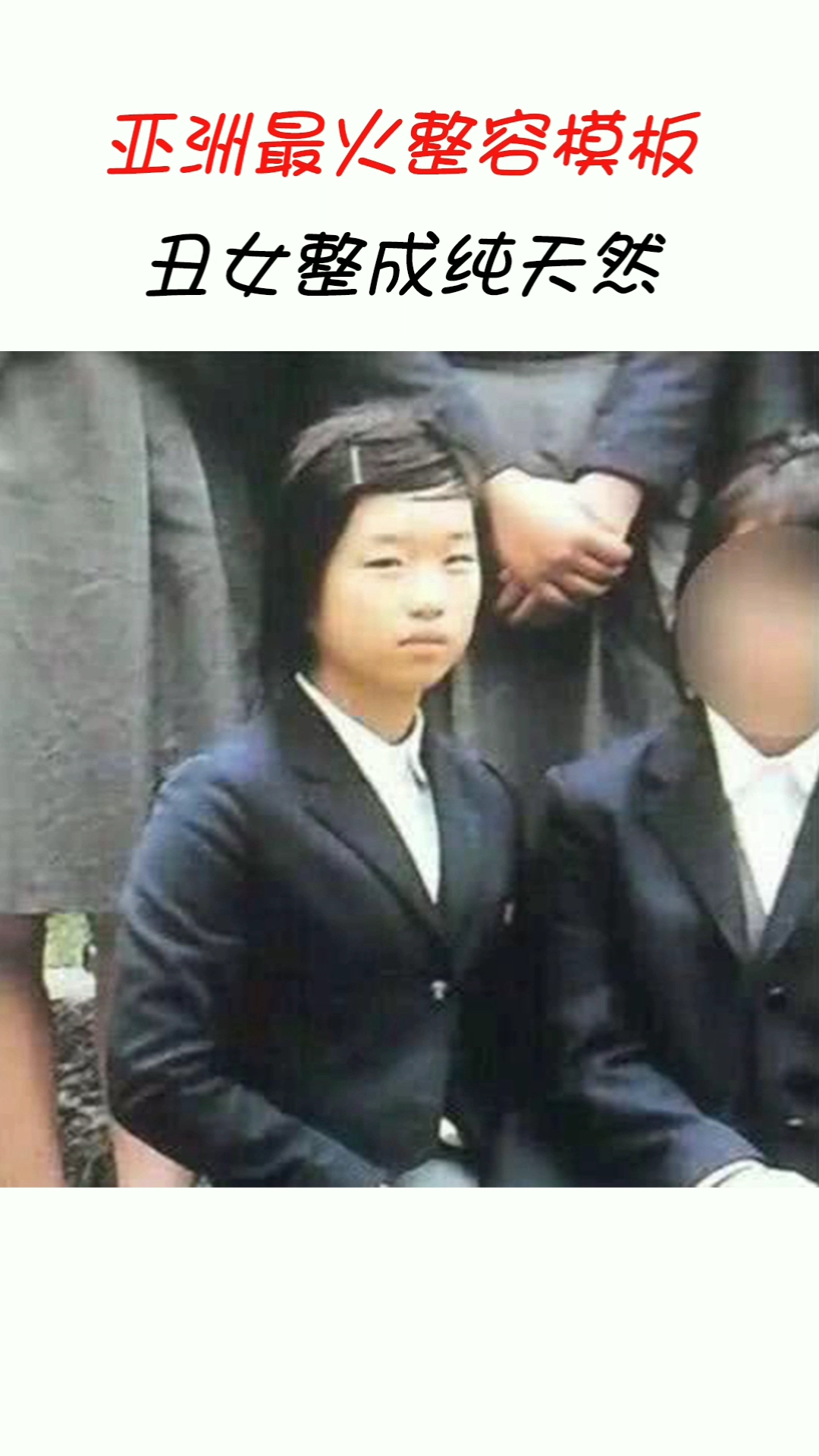 亚洲最火整容模板,看她整容前照片,医生拥有“上帝之手” 