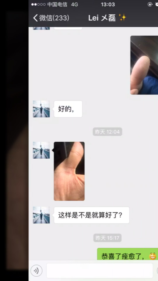 刺猴 鸡眼