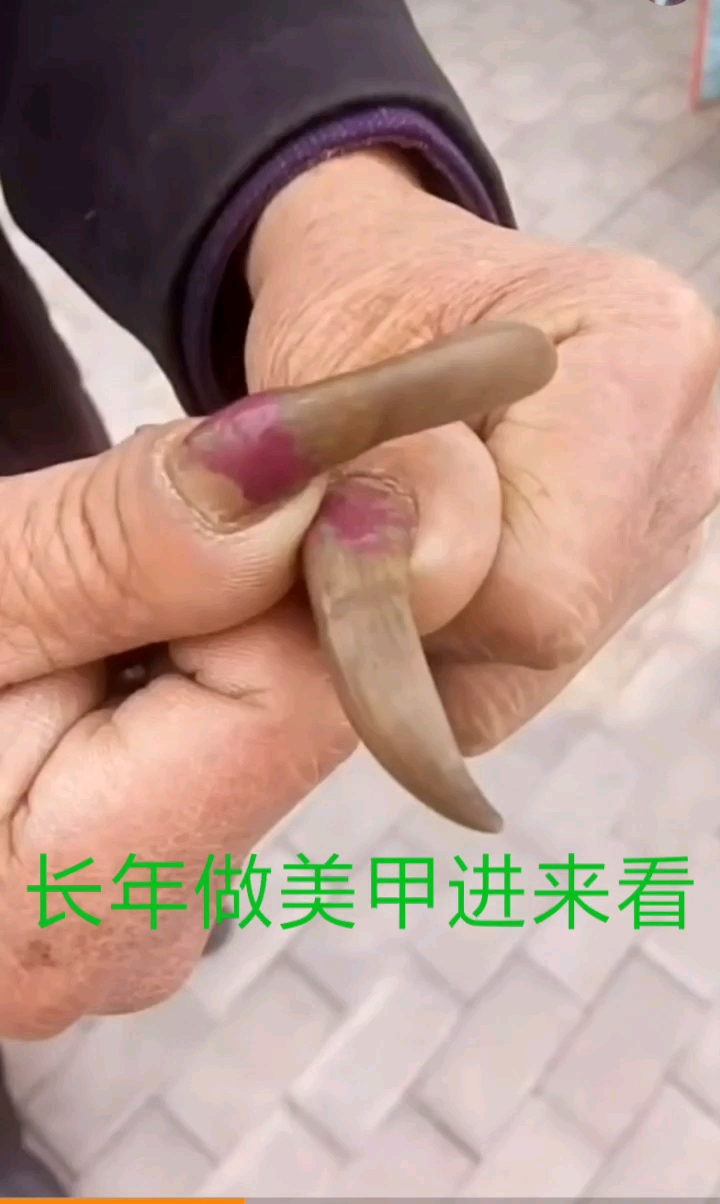 小米渲然指甲: ,我们是可以随时摘戴的,不用胶水,非常的健康,孕妇和宝宝都可以使