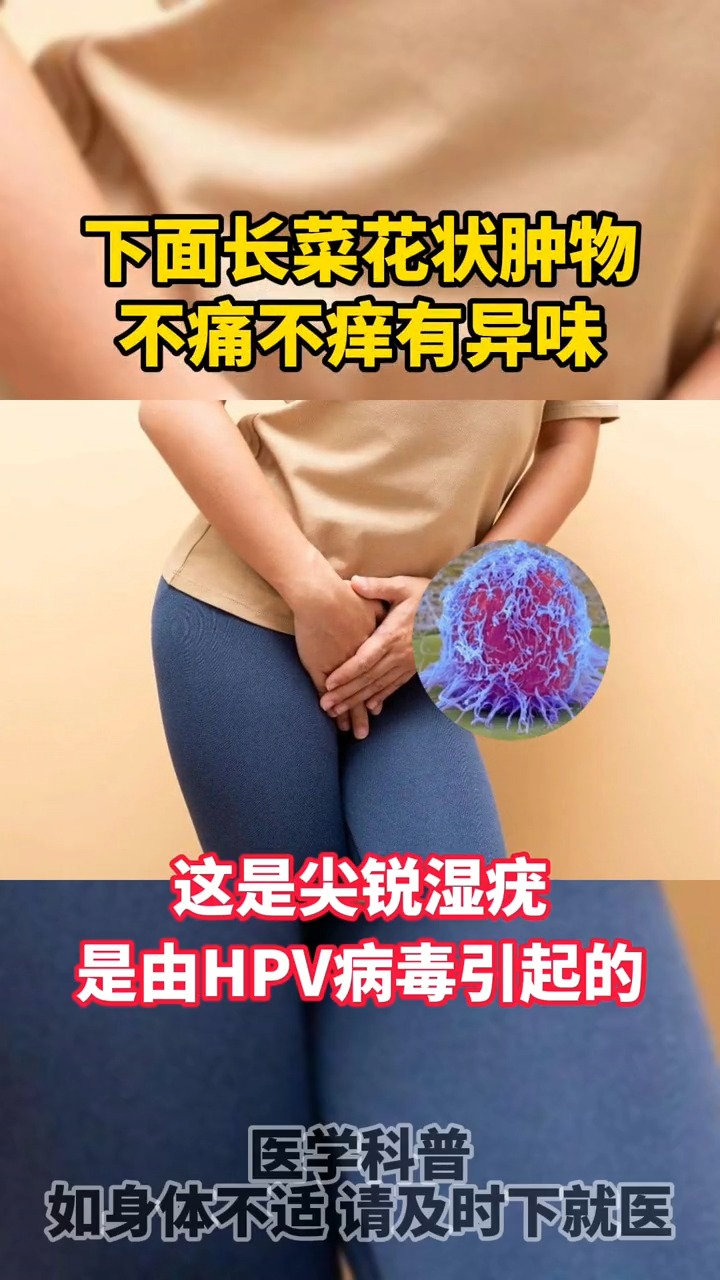 #健康养生#私处长菜花状肿物，要警惕！会传染！