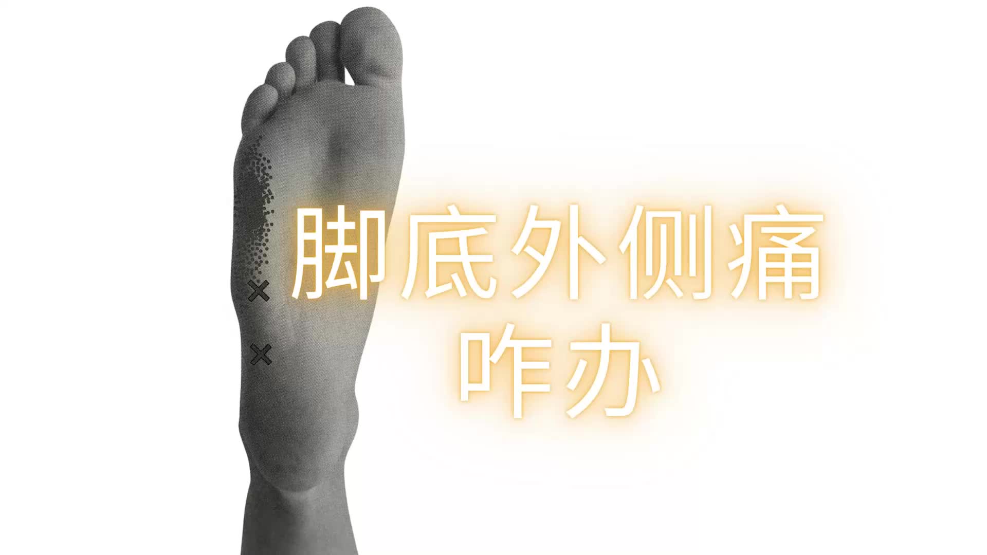 跑步伤痛不求人 脚底外侧痛咋办?