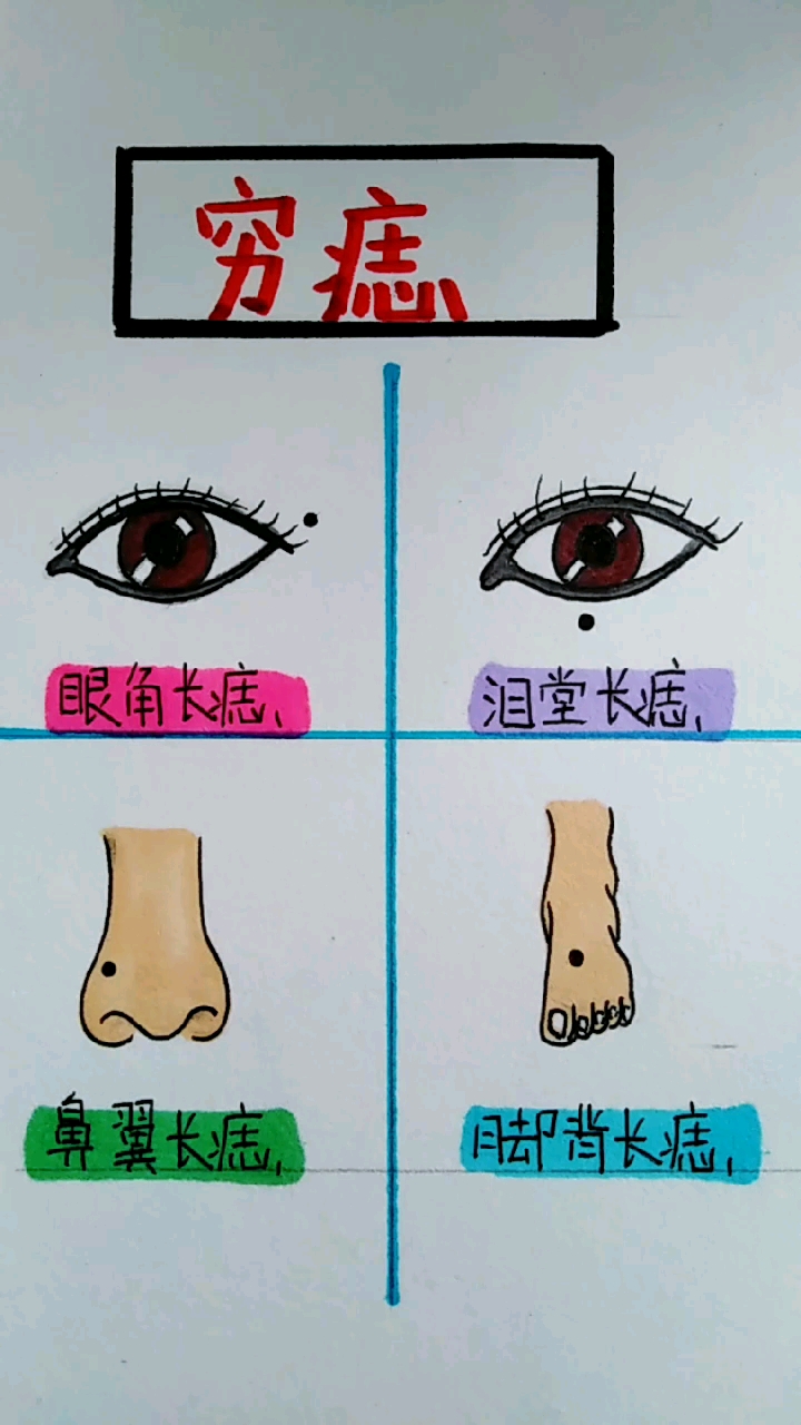 穷痣。眼角长痣、泪堂长痣。鼻翼长痣却背长痣