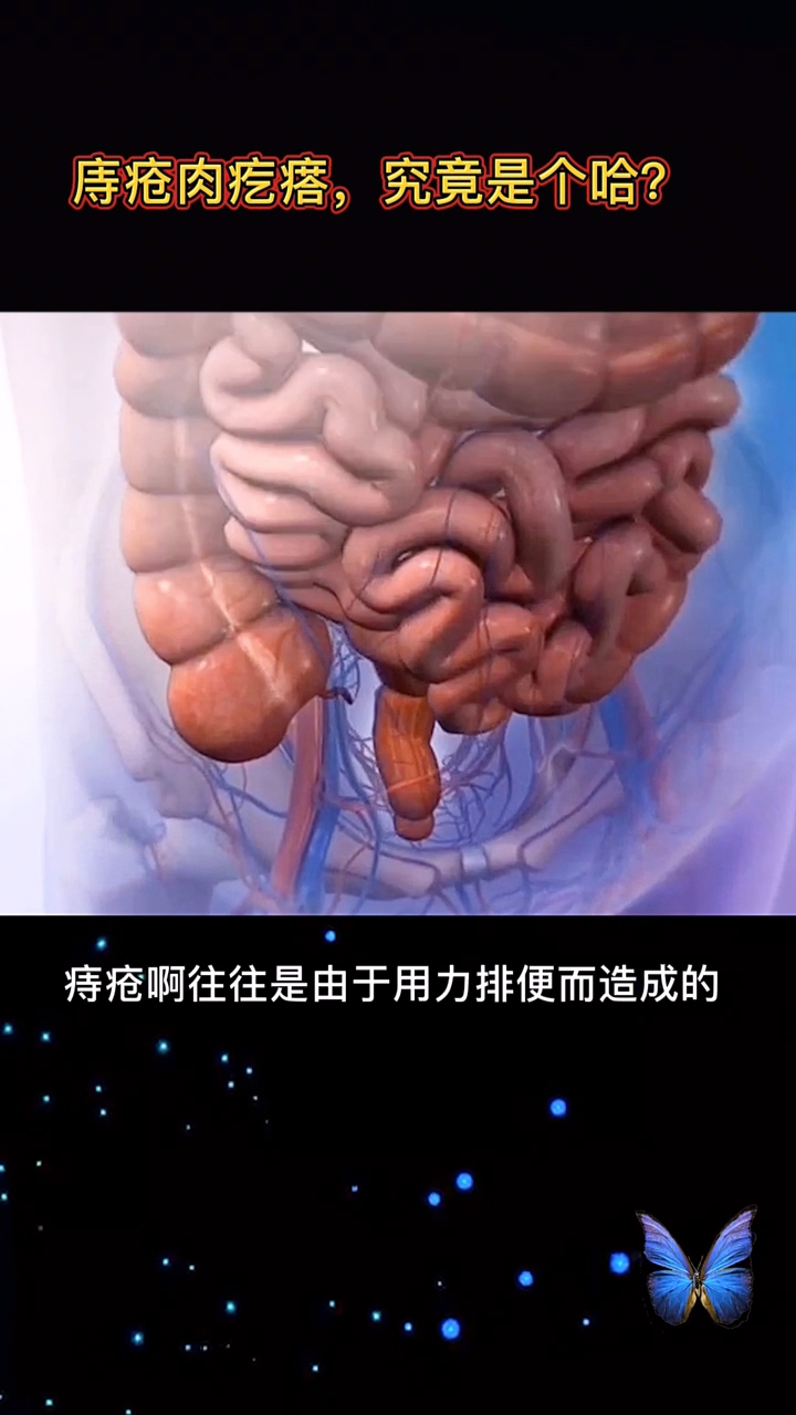 庤疮肉疙瘩,究竟是个啥?