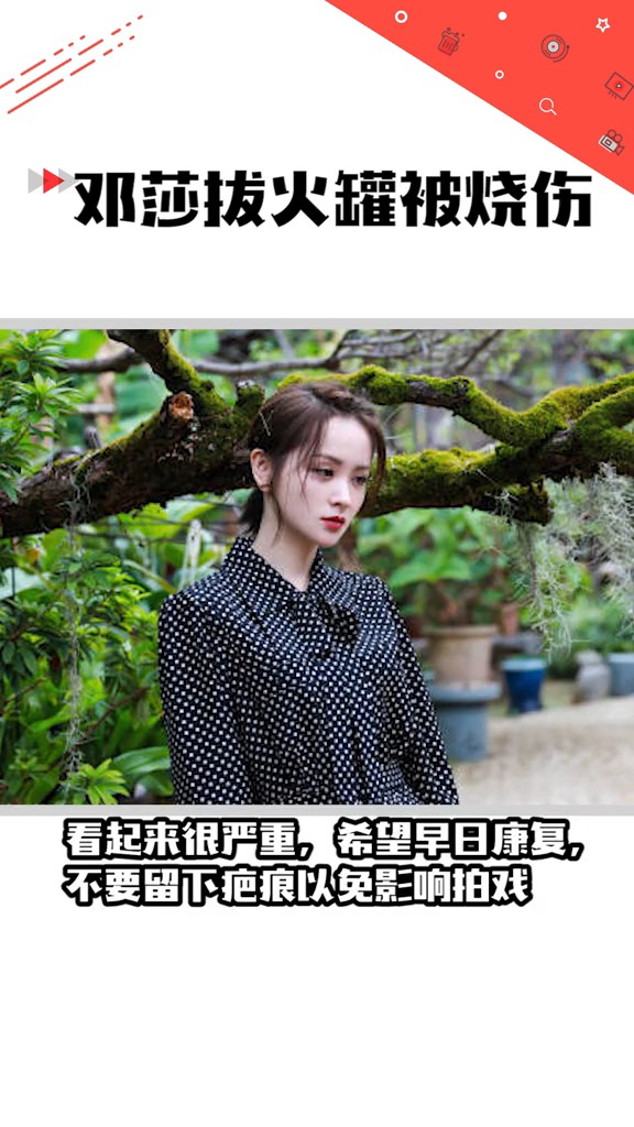 邓莎 拔火罐被烧伤,好严重啊,希望早日康复