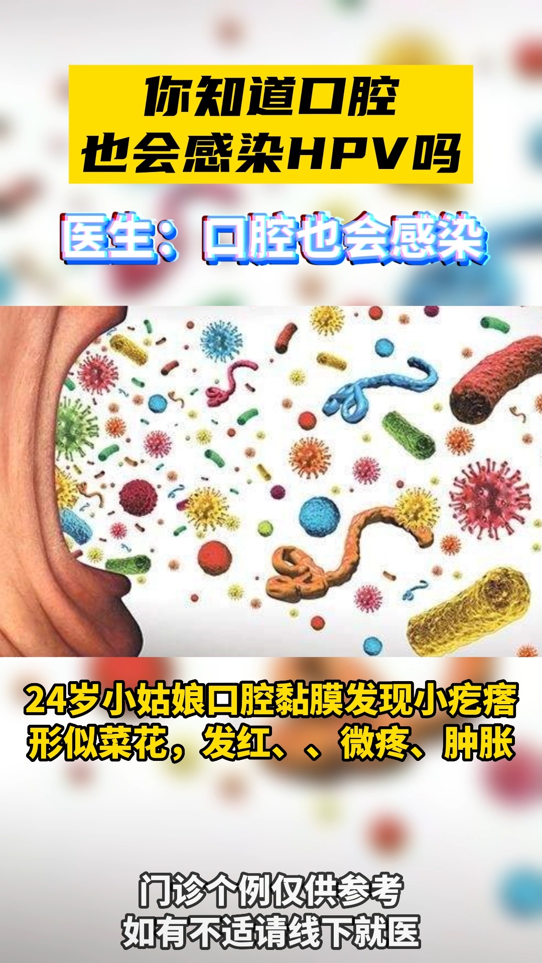 #关爱女性健康#你知道口腔也会感染HPV吗?