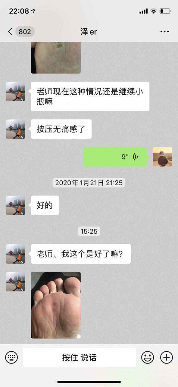 鸡眼 刺猴