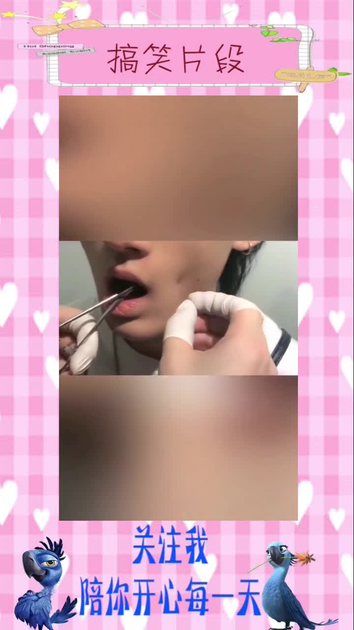 小哥哥在脸上打酒窝钉,三个月之后拆下来,笑一下那一瞬间帅爆了,搞笑视频