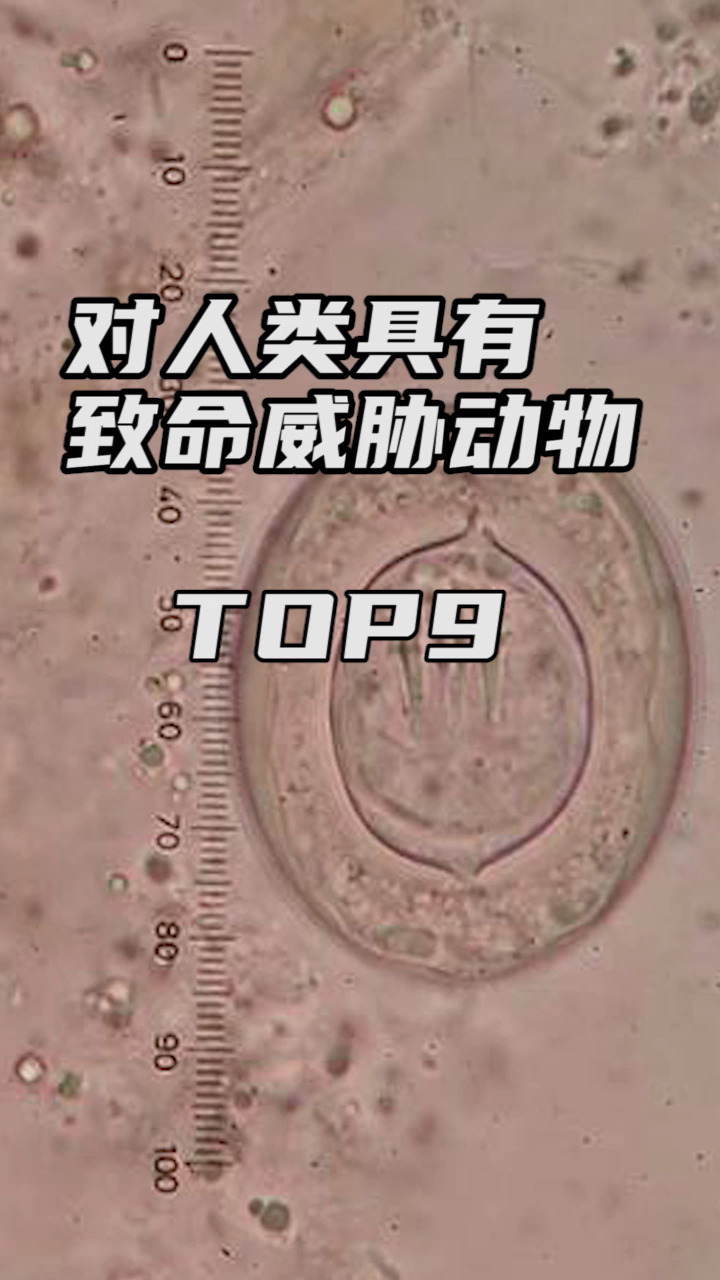 #神奇动物在这里#对人类具有致命威胁的动物排行榜TOP9绦虫