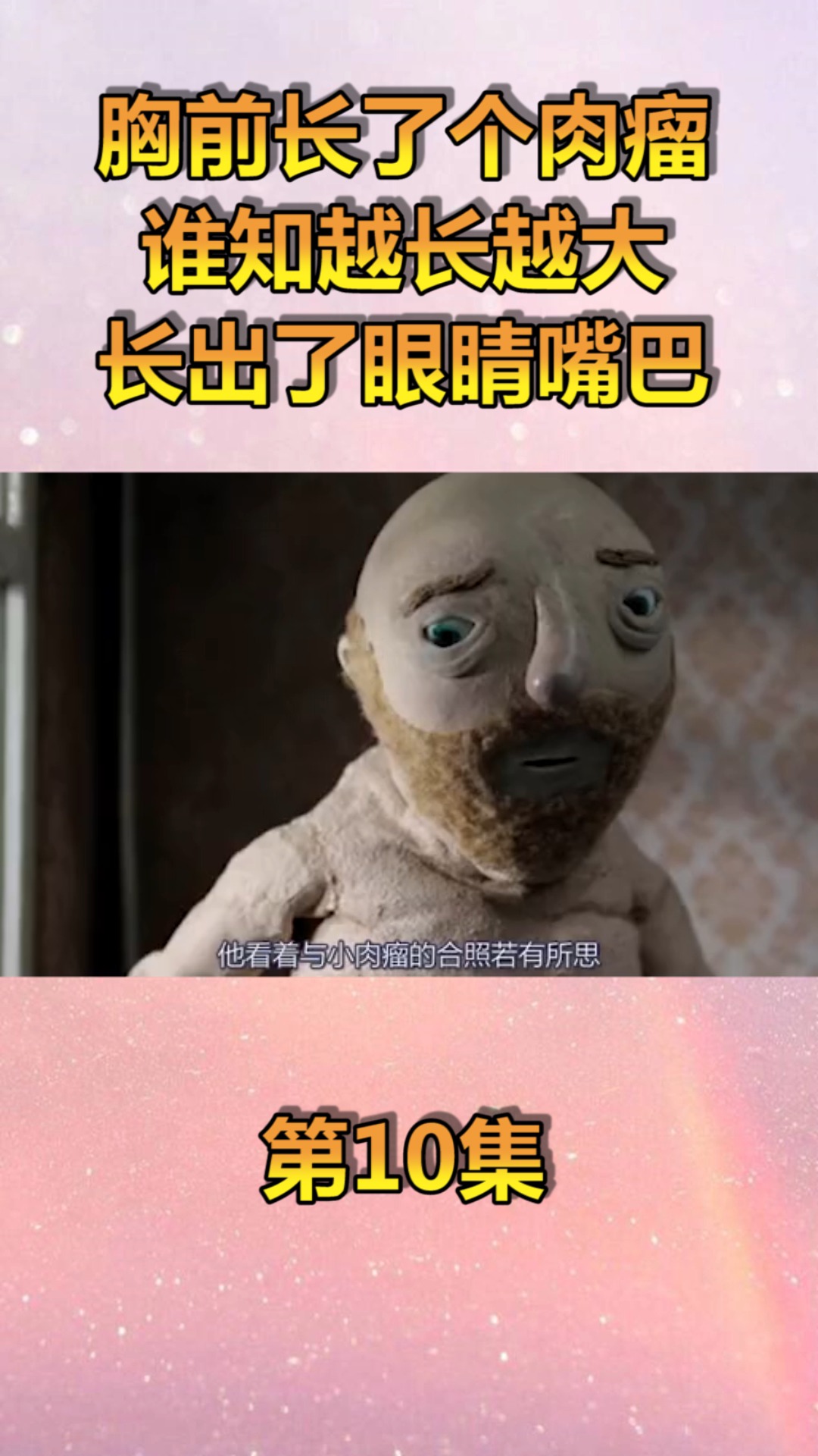 #动漫#胸前长了肉瘤,谁知越长越大,还长出了眼睛和嘴巴!(10)