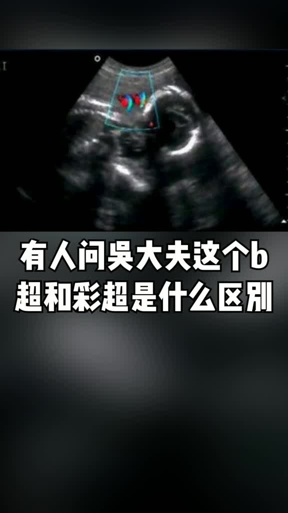 吴医生好友聊你觉得超声有辐射么