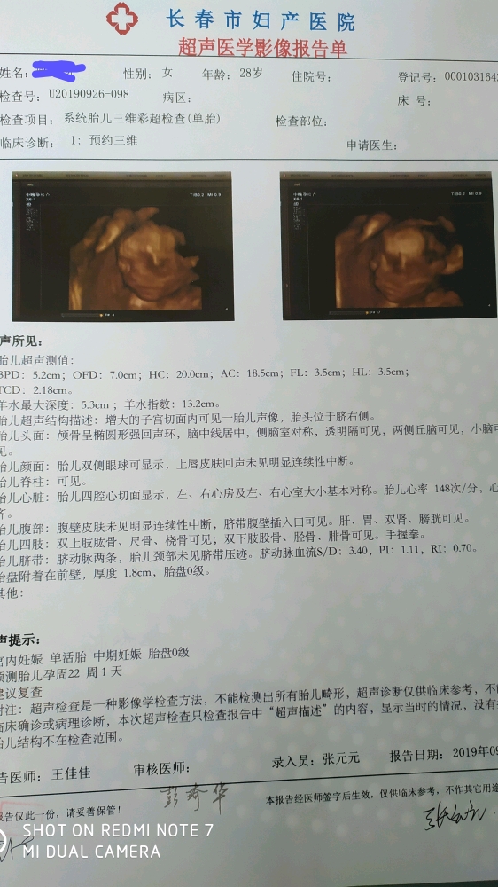 孕36周这两天吃饭胀的难受,看来得少食多餐,吃点易消化的,孕晚期也难受。