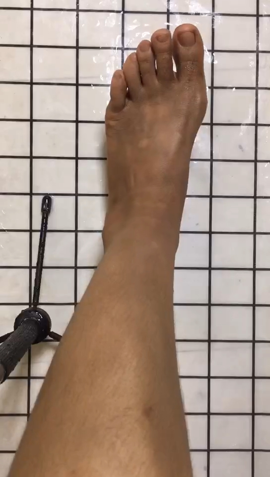 鸡皮肤,皮肤粗糙 干燥,起皮 黑,跟着我这样做 