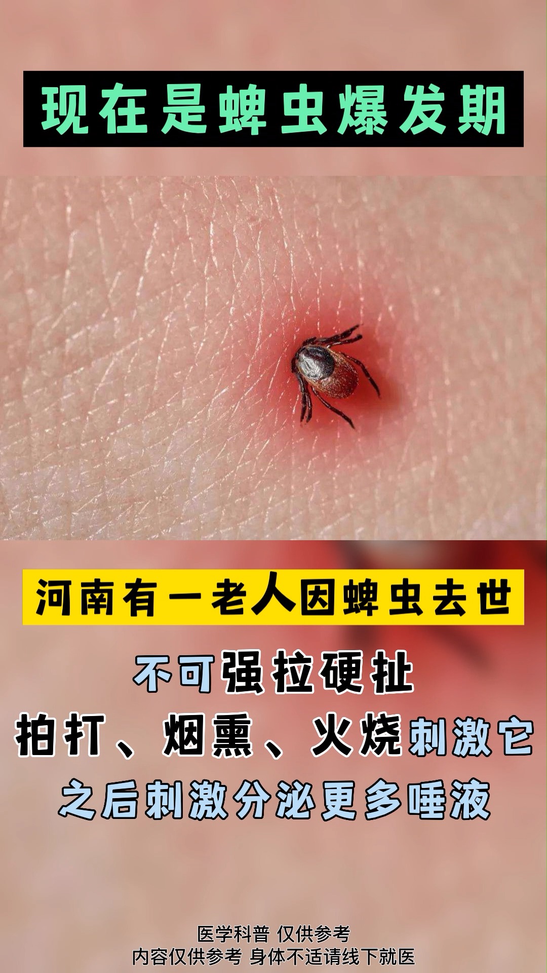 #蜱虫#现在是蜱虫爆发的季节,如果发现自己身上爬了蜱虫,千万别自己使劲拽!