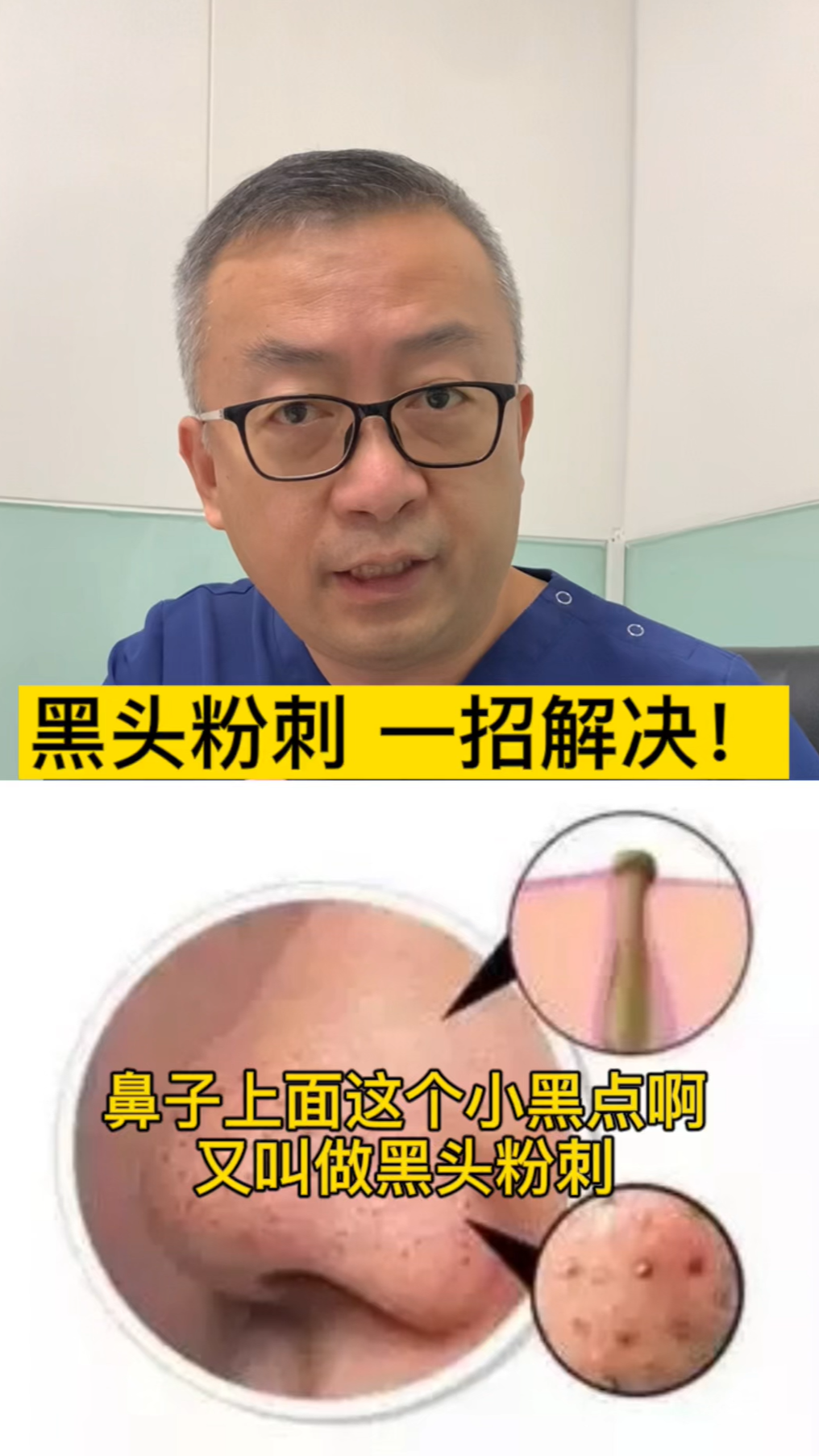 #健康养生#正确的用药和合理的饮食生活习惯,才能彻底摆脱痘痘的烦恼!