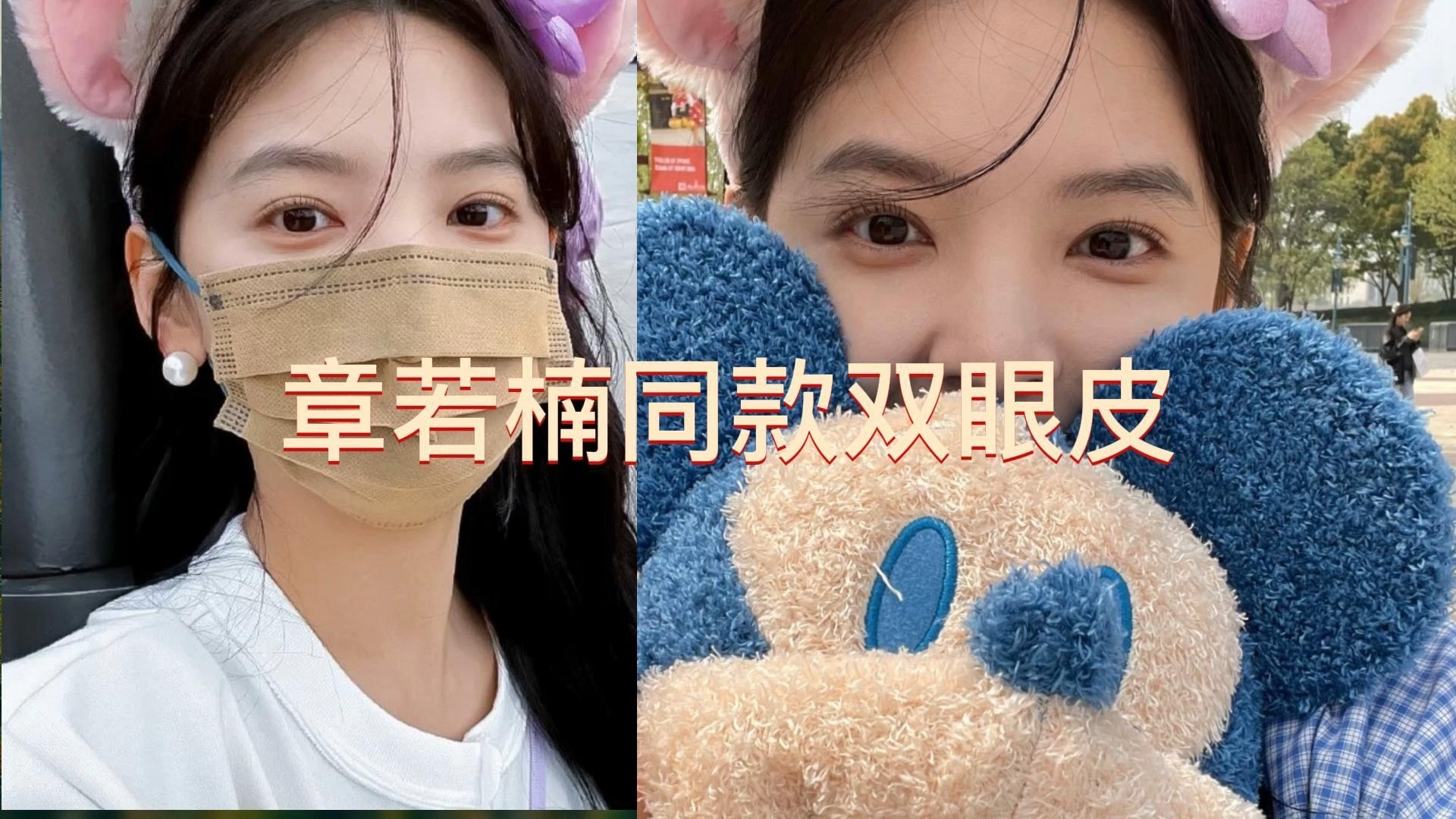 肉眼泡做双眼皮可功课:张大艳、许莲姬、杨锴、秦小惠、韩新鸣、武凤莲、卢建建