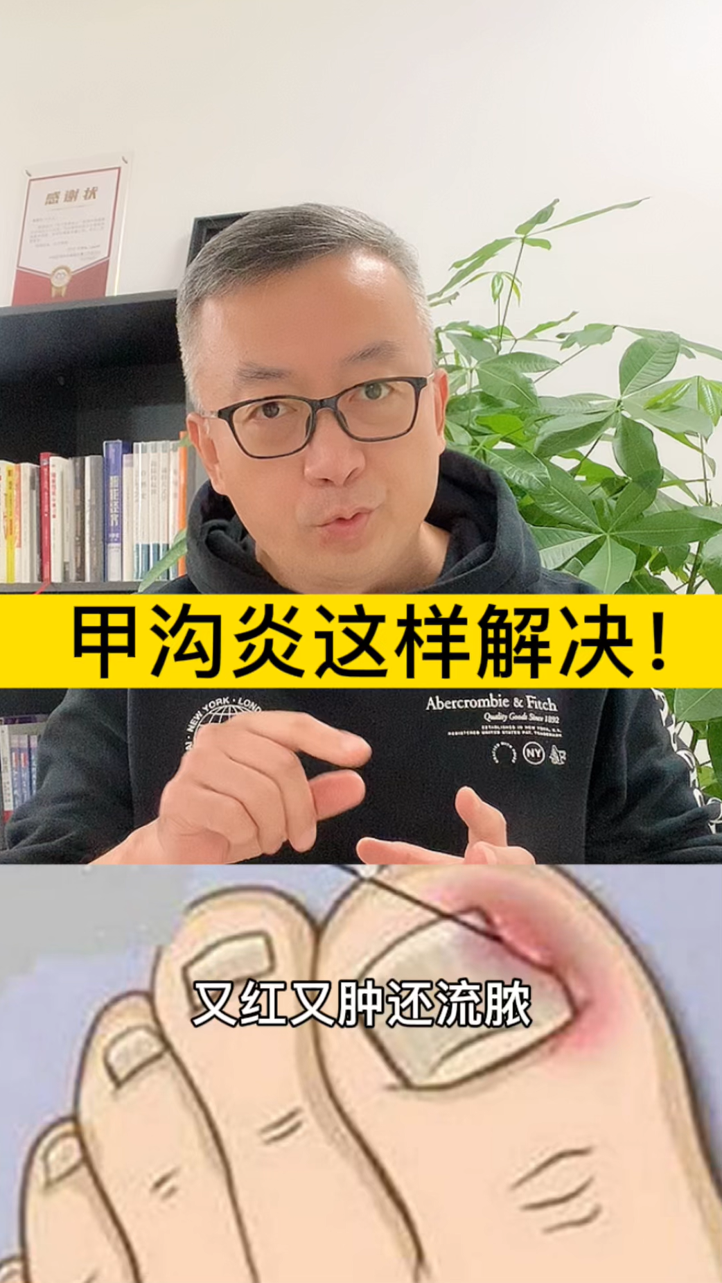 #健康养生#脚趾头旁边的肉又红又肿还流脓，这是甲沟炎，这样处理就能轻松解决！