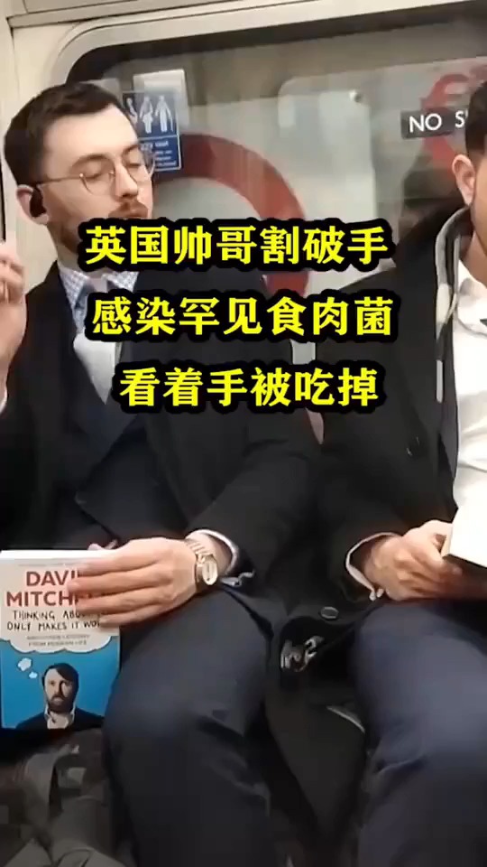 英国帅哥割破手感染罕见食肉菌看着手被吃掉