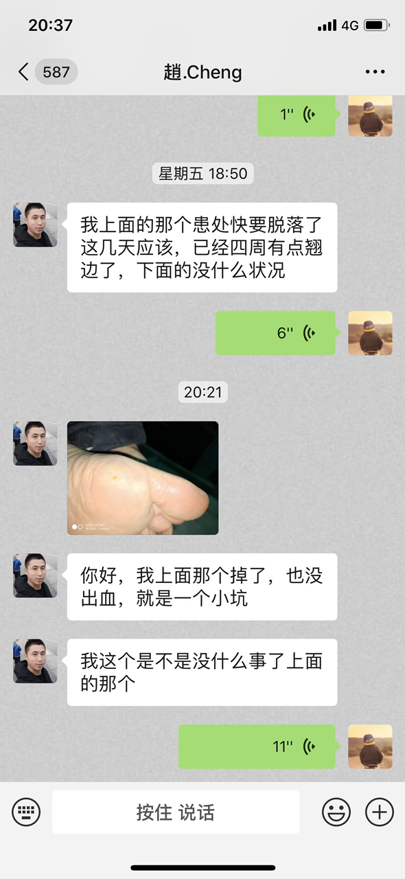鸡眼 刺猴