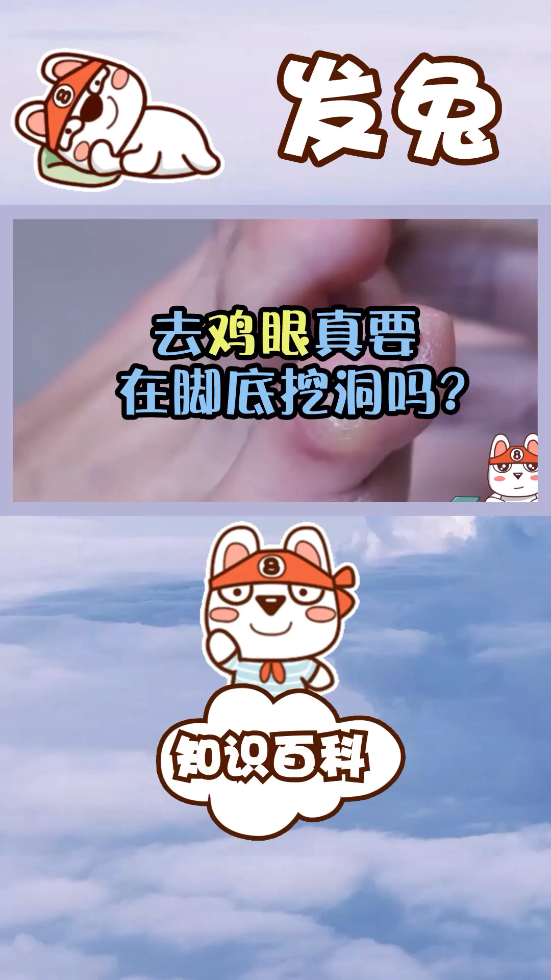 鸡眼是扎刺还是病毒?去鸡眼真要在脚底挖洞吗?