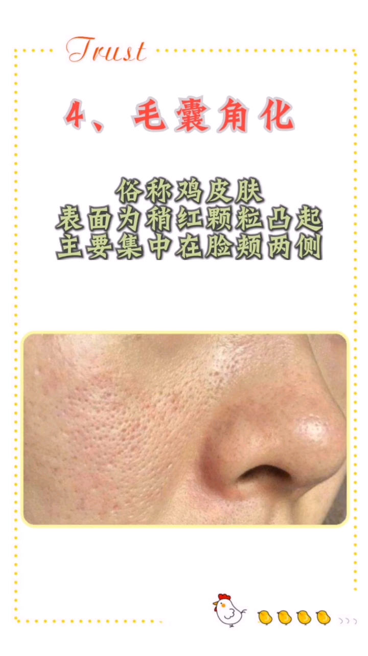 看看你脸上有没有这些东西,可一定要及时处理哦#护肤#变美#
