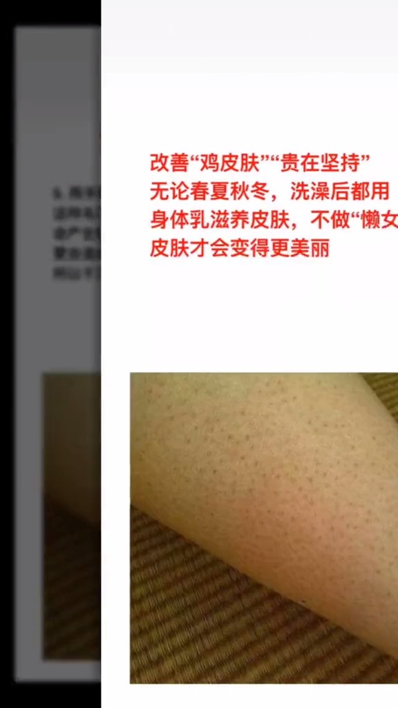#美容护肤#鸡皮皮肤如何护理