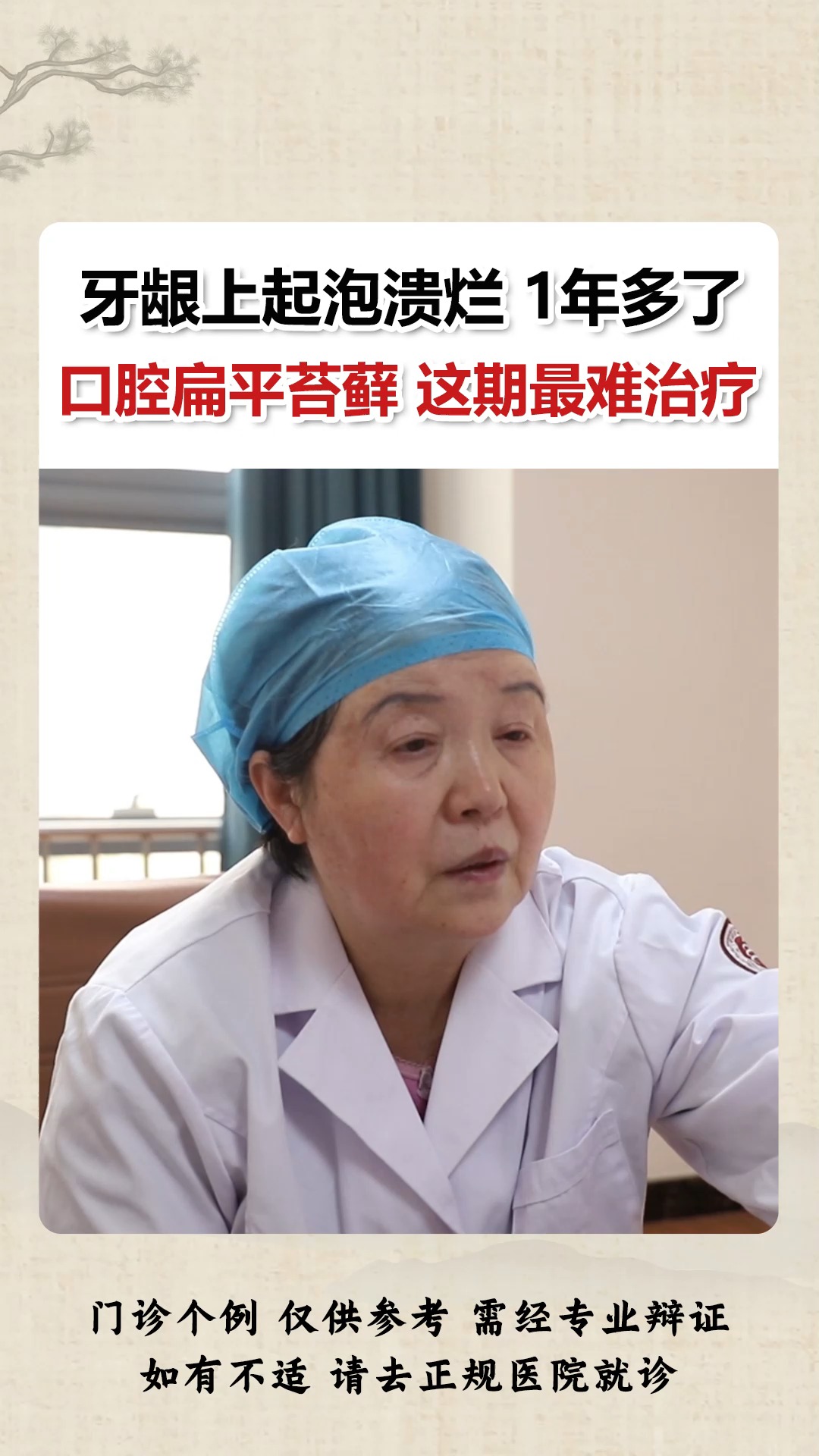#口腔扁平苔藓#牙龈上起泡还溃烂 1年多了 口腔扁平苔藓 分三期 这期最难治疗