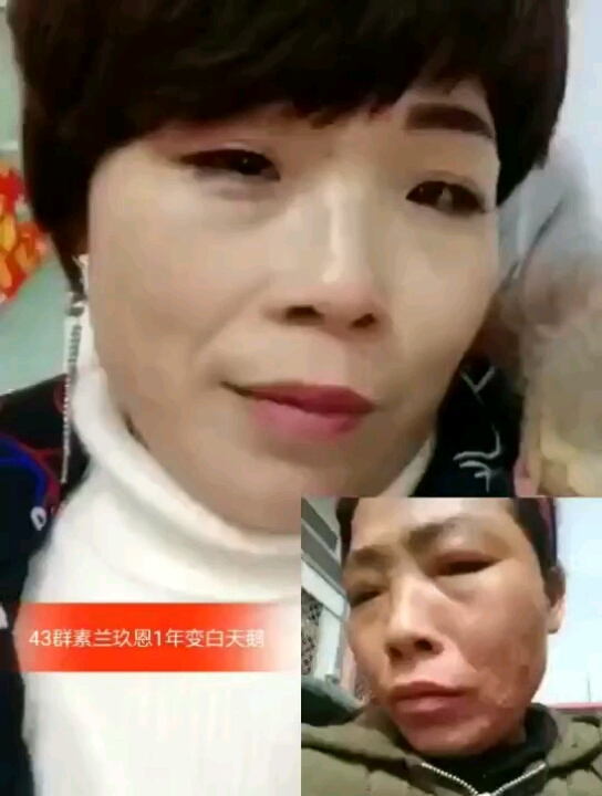 丑小鸭与天鹅之前就差一瓶玖恩!!