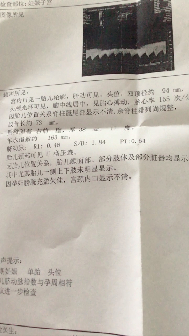 有能看出男孩女孩的吗