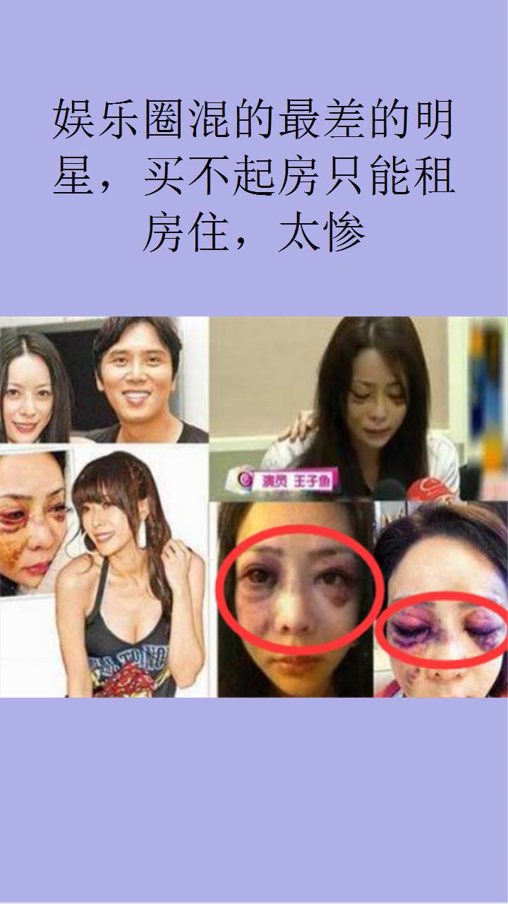 娱乐圈那些混到只能租房子照顾