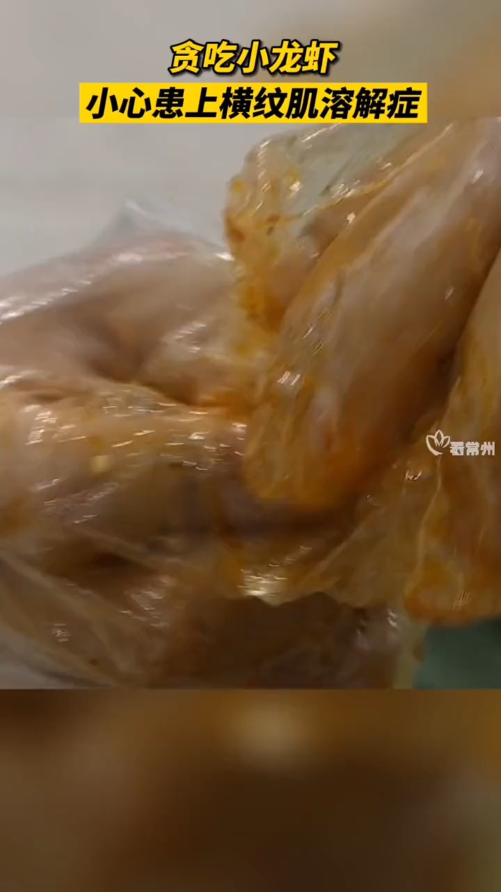 龙虾好吃不要贪嘴!常州市民王先生吃完龙虾后突现肌肉酸痛、乏力尿褐色等症状.