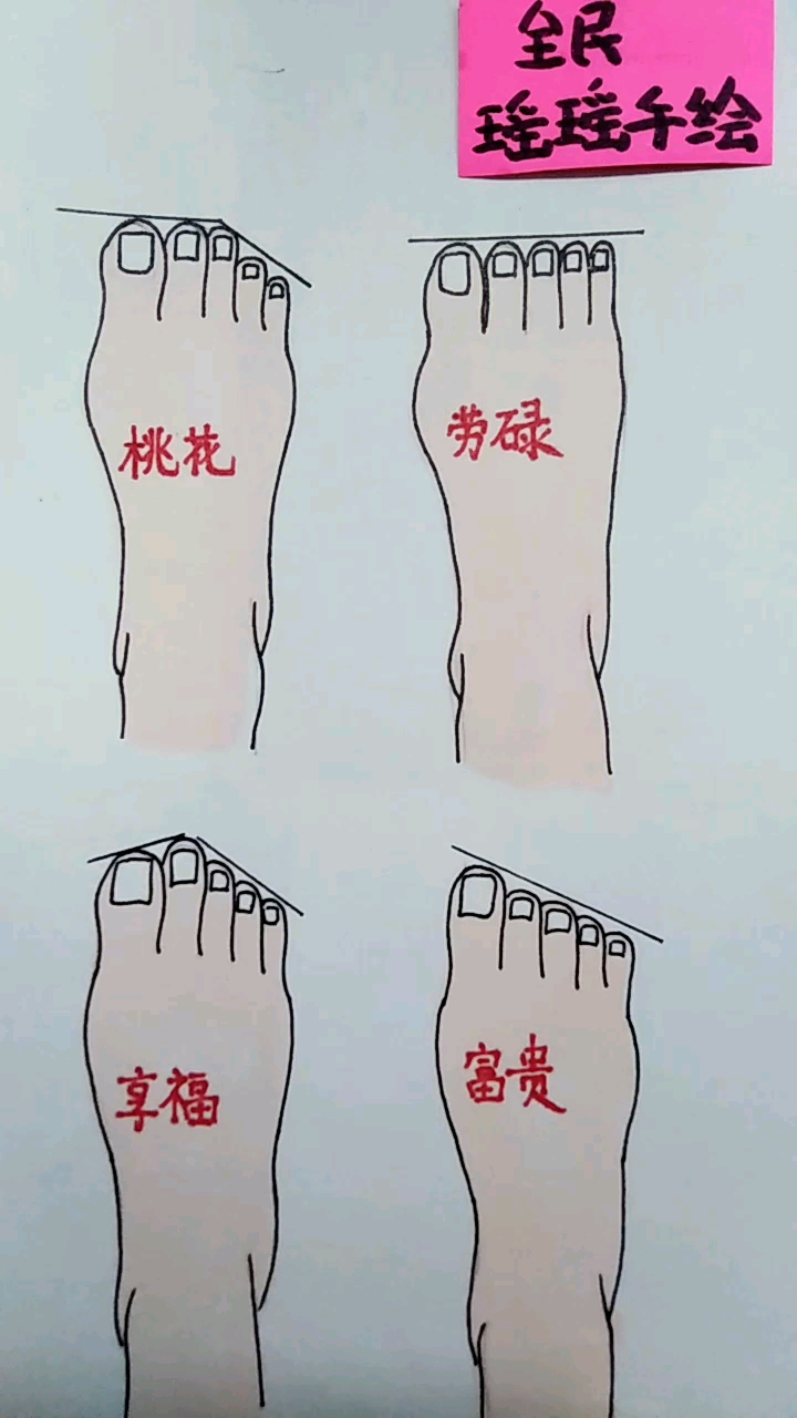 你是哪种?