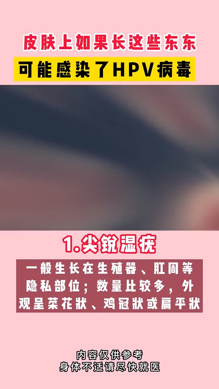 #HPV感染#如果你有上述症状 可以给我留言 我来帮你