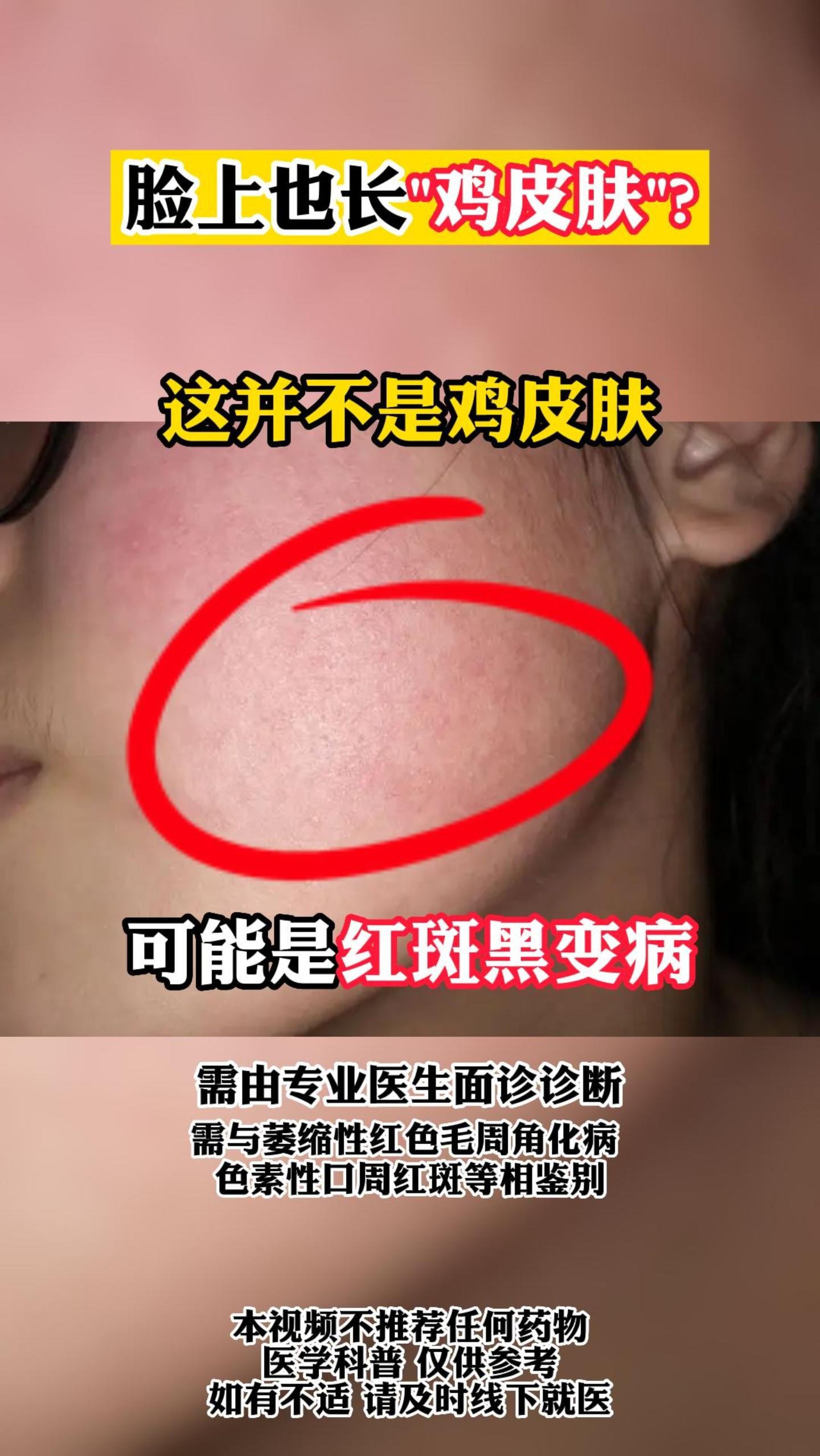 #知识科普#脸上也长