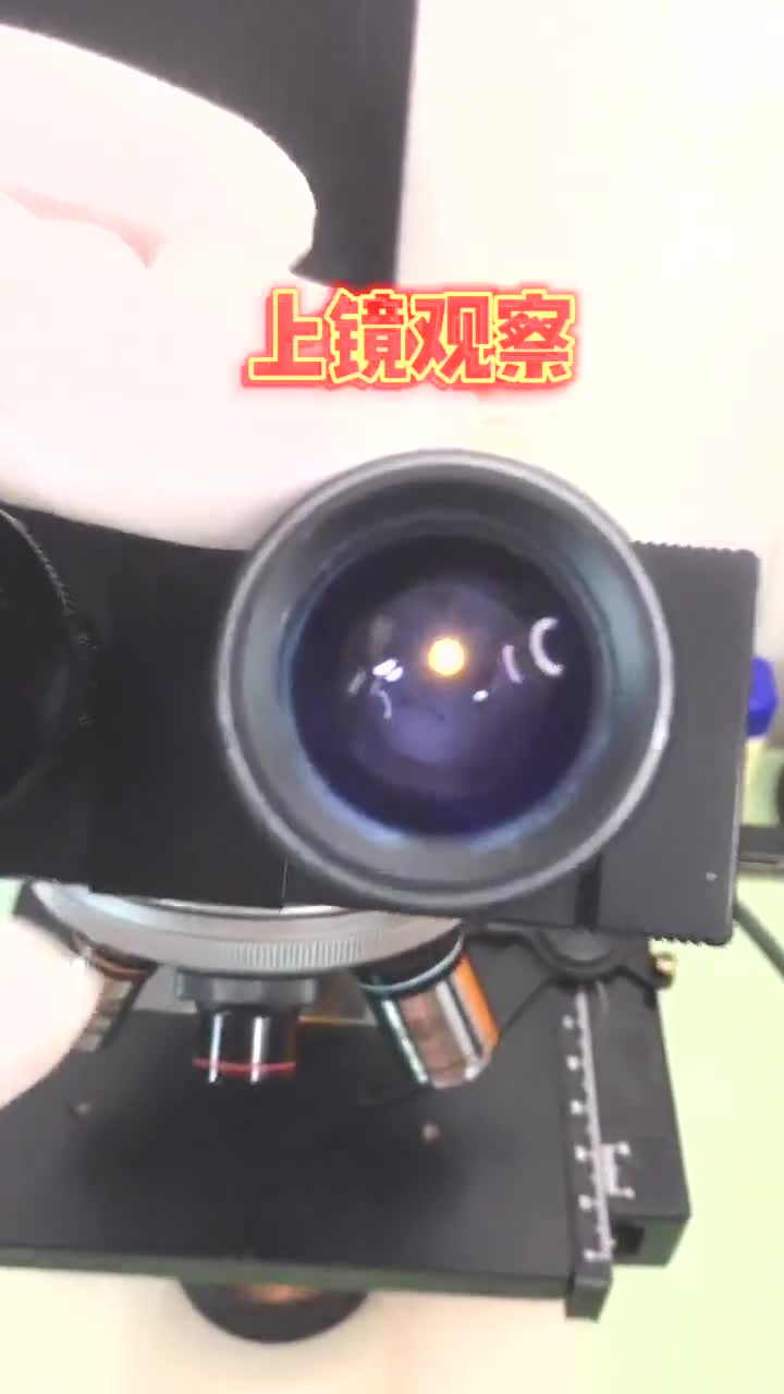 平时吃的槟榔,显微镜放大1000倍,您会看到什么