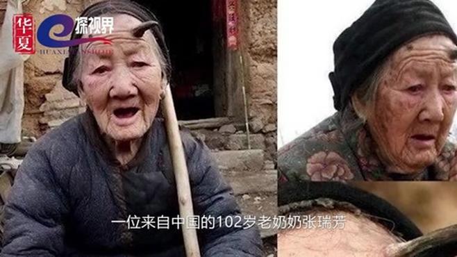 [图]世界上5个奇怪的人！头上竟然会长出角来！了解一下