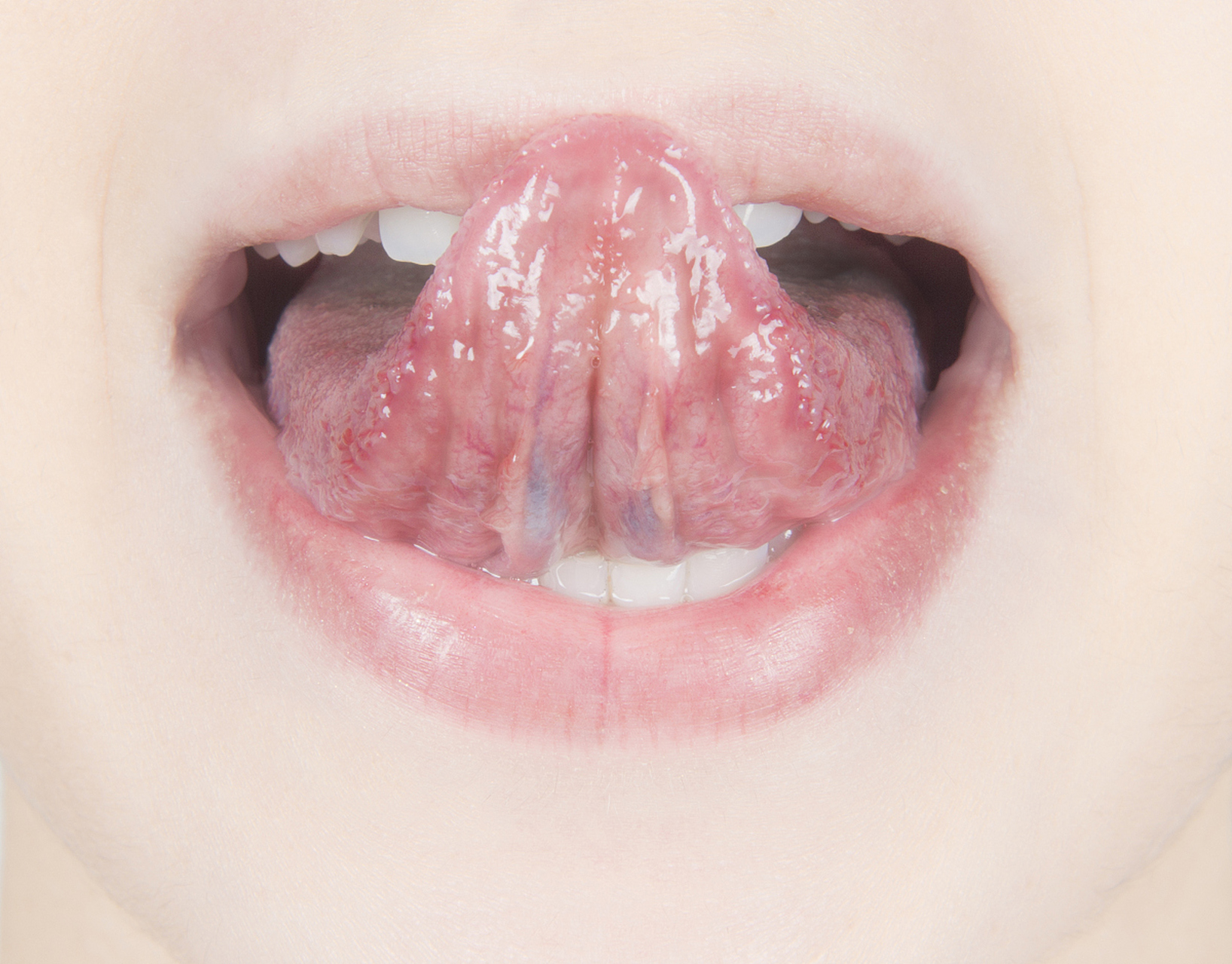 舌头连着筋图片图片