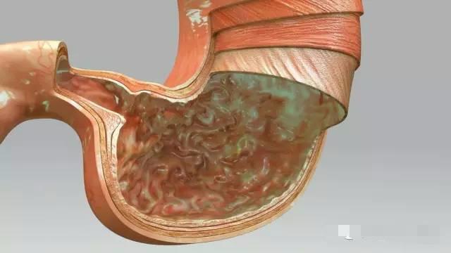 什么是肠化生?见于多种慢性胃病,不可掉以轻心