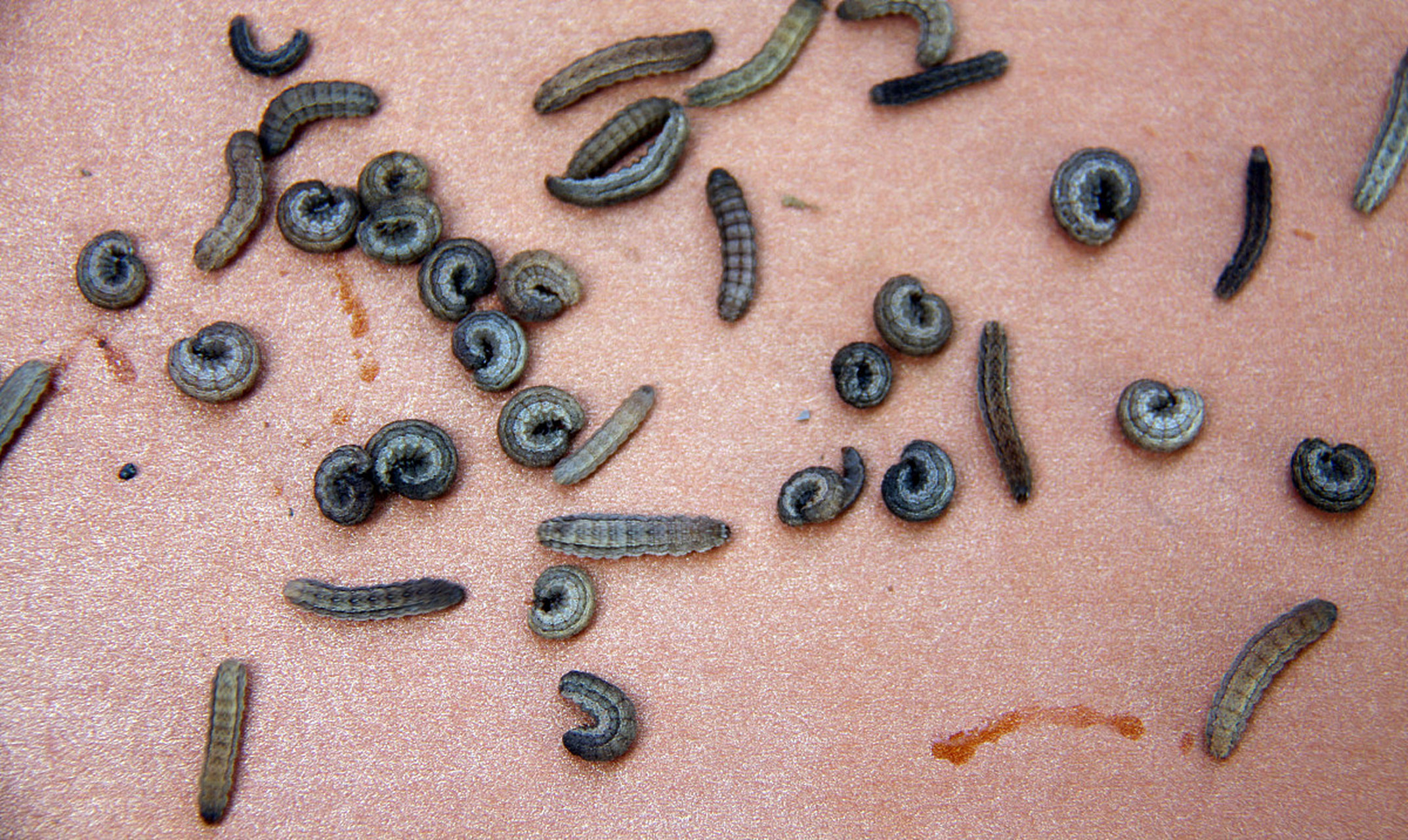 近日,广西南宁发生了一起肝吸虫病的案例.