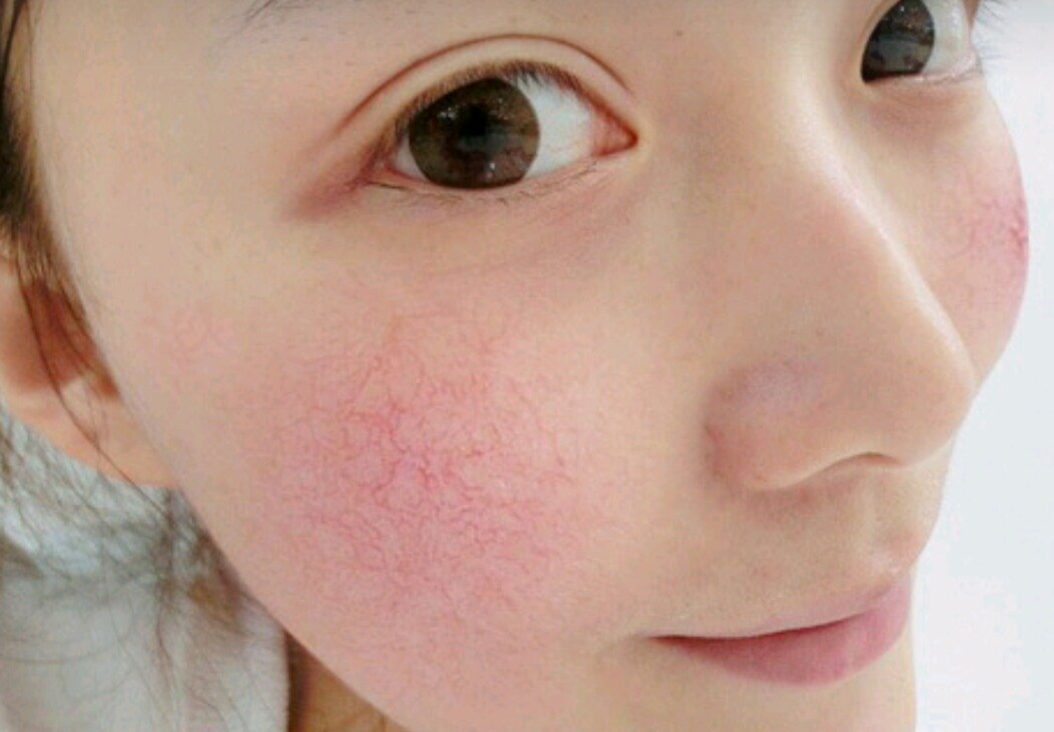 早上不能用洗面奶!难怪脸干还蜕皮,油皮也洗成了敏感肌!