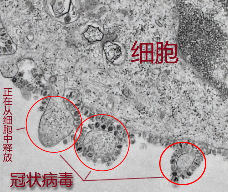 病毒放大10万倍的图片图片