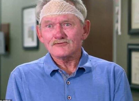 男子额头长角酷似"独角兽",每天戴帽子怕被人看见